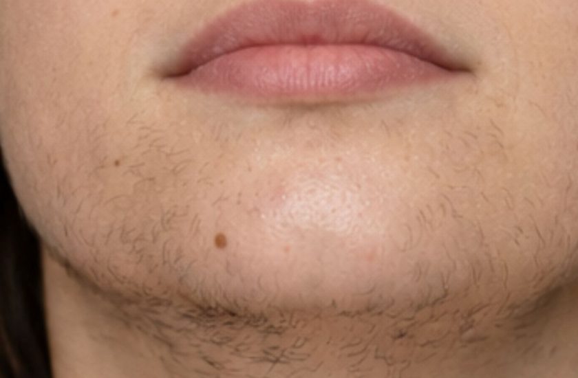 WhatsApp Image 2026-02-03 at 3.27.07 AM (1)